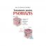 Tratamente pentru psoriazis (ed. tiparita)